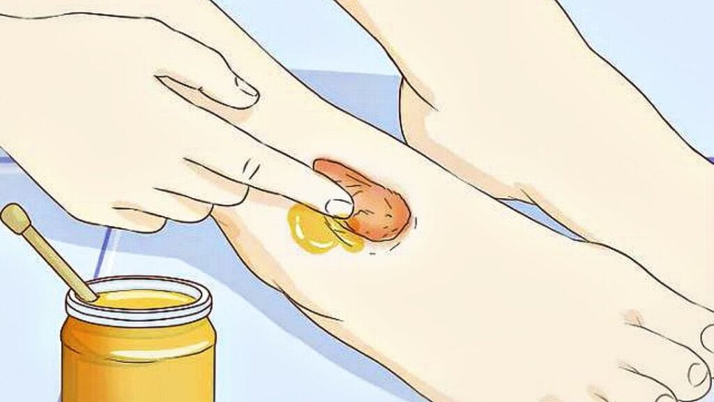 Как быстро убрать царапины на теле?