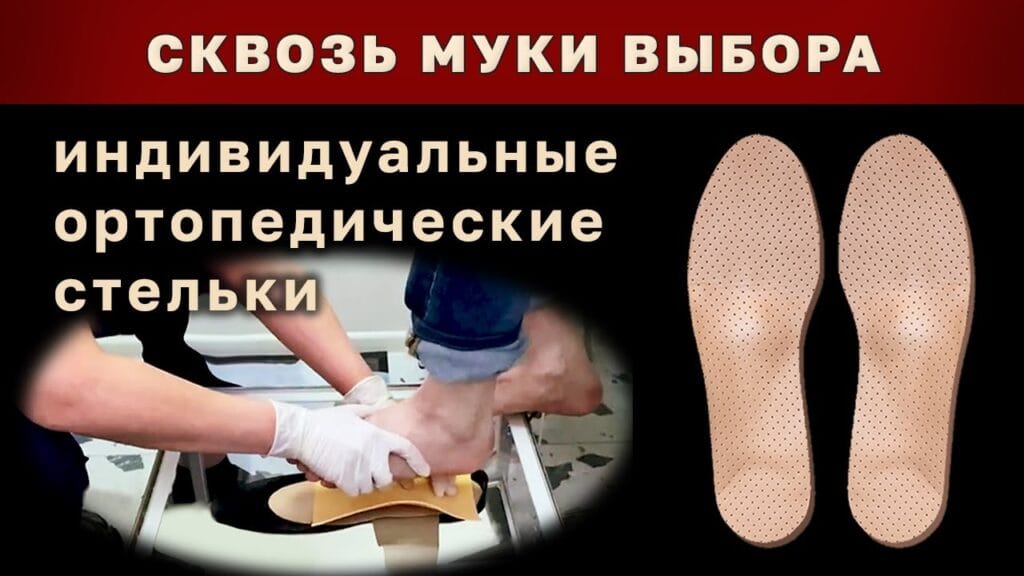 Можно ли получить индивидуальные ортопедические стельки без врача?
