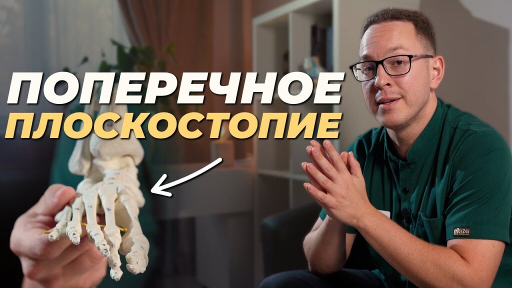 Может ли обувь стать причиной плоскостопия?